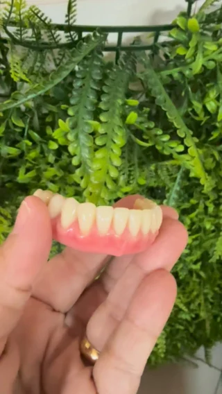 Prótese protocolo! Um sorriso fixo muda mais do que a estética… transforma a forma como você se posiciona no mundo ✨

A prótese protocolo sobre implantes é uma solução moderna, segura e planejada para devolver função, estabilidade e naturalidade ao sorriso — tudo de forma personalizada para cada paciente.

Neste caso, trabalhamos cada detalhe: posição dos implantes, proporção dos dentes e harmonia facial, buscando um resultado que não apenas parece natural… mas que se sente assim todos os dias.

E o mais interessante? Existe um ponto no planejamento que faz toda a diferença no resultado final — e quase ninguém sabe disso.

Se você está considerando esse tipo de tratamento, vale a pena entender antes de tomar qualquer decisão.

📩 Me chama no direct ou clique no link da bio para saber mais.
#implantesdentarios #implantodontia #proteseprotocolo #sorrisofixo #dentistaespecialista